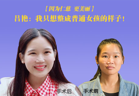 因為仁慈更美麗|呂艷：我只想整成普通女孩的樣子